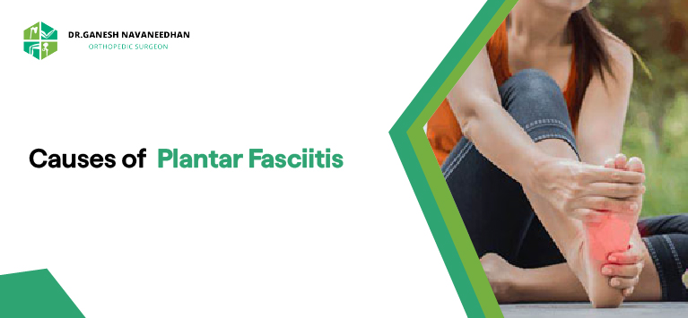 plantar fasciitis