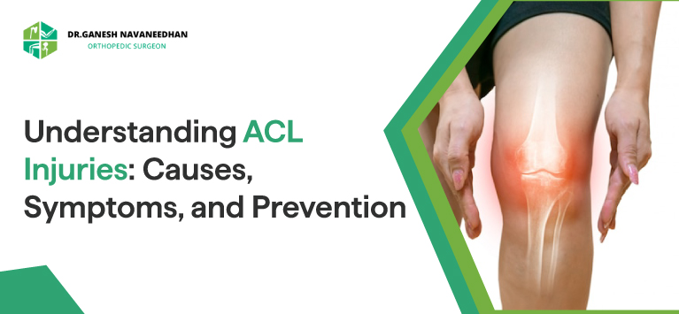 Understanding ACL Injuries - Causes, Symptoms, and Prevention