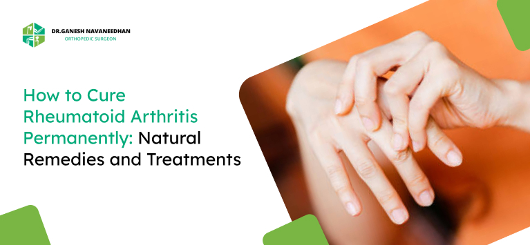How to Cure Rheumatoid Arthritis Permanently