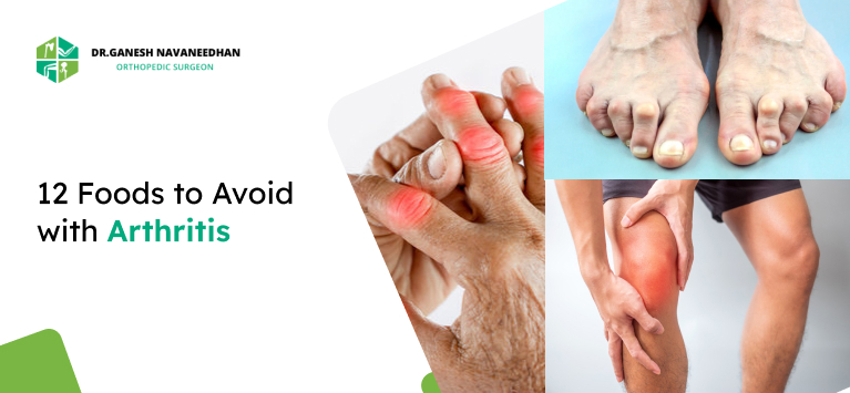 12 Foods to Avoid with Arthritis