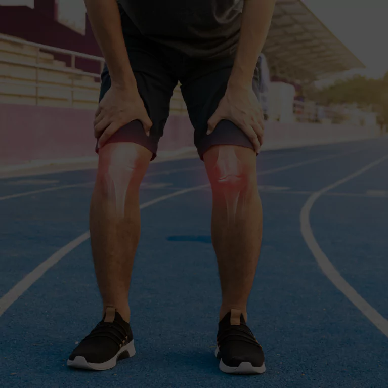 Anterior cruciate ligaments (ACL)