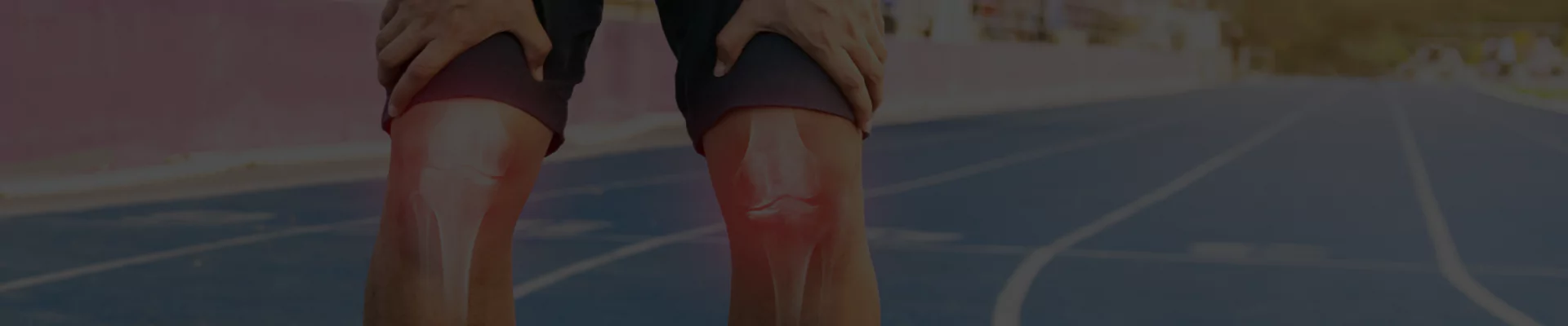 Anterior cruciate ligaments (ACL)