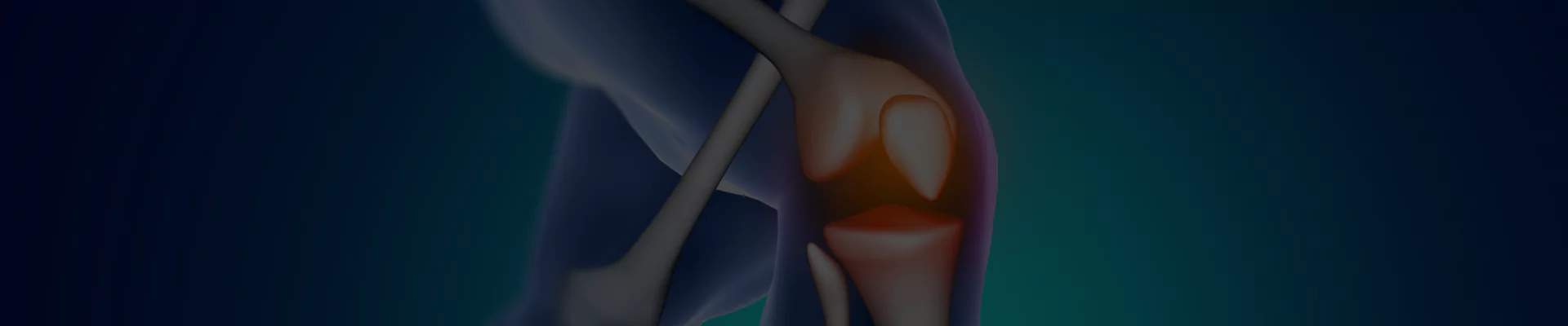 Knee Replacement Surgery