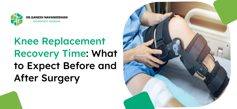 Knee Replacement Recovery Time