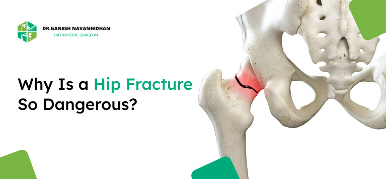 Why Is a Hip Fracture So Dangerous