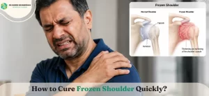 How to Cure Frozen Shoulder Quickly