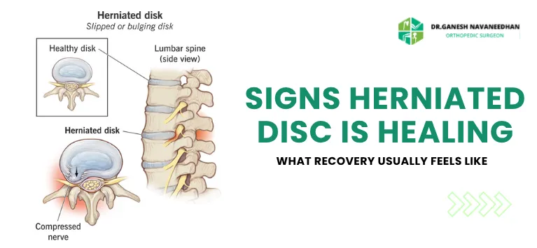 Signs Herniated Disc Is Healing