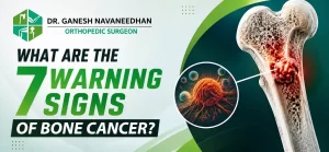 What Are the 7 Warning Signs of Bone Cancer