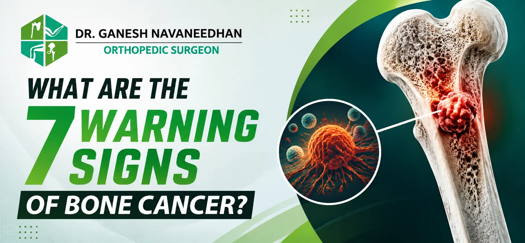 What Are the 7 Warning Signs of Bone Cancer
